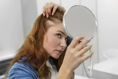 Terapia Vampir pentru chelie și alopecie